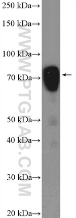 ESRP1 Antibody in Western Blot (WB)