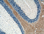 GLUT4 Antibody in Immunohistochemistry (Paraffin) (IHC (P))