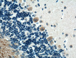 GLUT4 Antibody in Immunohistochemistry (Paraffin) (IHC (P))