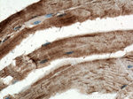 GLUT4 Antibody in Immunohistochemistry (Paraffin) (IHC (P))