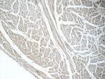 GLUT4 Antibody in Immunohistochemistry (Paraffin) (IHC (P))
