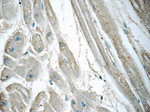GLUT4 Antibody in Immunohistochemistry (Paraffin) (IHC (P))
