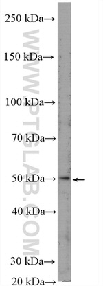 GLUT4 Antibody in Western Blot (WB)