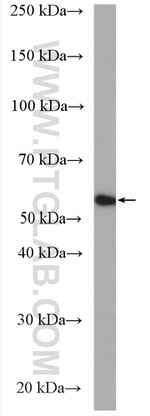 GLUT4 Antibody in Western Blot (WB)