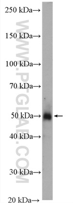 GLUT4 Antibody in Western Blot (WB)
