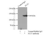 FLT3 Antibody in Immunoprecipitation (IP)