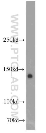 FLT3 Antibody in Western Blot (WB)