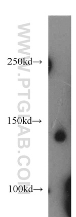 FLT3 Antibody in Western Blot (WB)