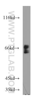 UBXD2 Antibody in Western Blot (WB)