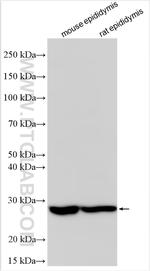 LHFPL5 Antibody in Western Blot (WB)