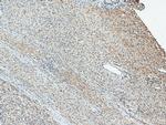 PNO1 Antibody in Immunohistochemistry (Paraffin) (IHC (P))