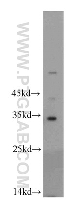 PNO1 Antibody in Western Blot (WB)