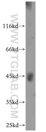 ANKMY2 Antibody in Western Blot (WB)