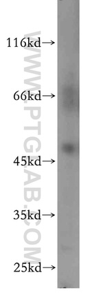 ANKMY2 Antibody in Western Blot (WB)