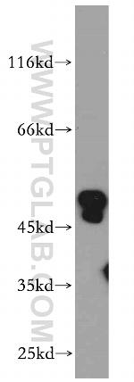 ANKMY2 Antibody in Western Blot (WB)