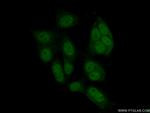 MAZ Antibody in Immunocytochemistry (ICC/IF)
