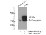 SIM2 Antibody in Immunoprecipitation (IP)