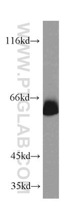 SIM2 Antibody in Western Blot (WB)