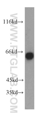 SIM2 Antibody in Western Blot (WB)