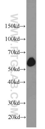 SIM2 Antibody in Western Blot (WB)