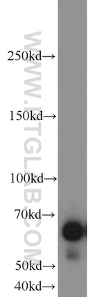 SIM2 Antibody in Western Blot (WB)