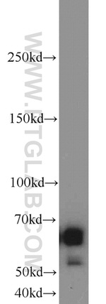 SIM2 Antibody in Western Blot (WB)