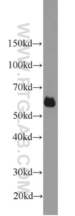 SIM2 Antibody in Western Blot (WB)