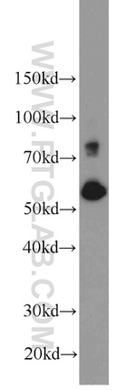 SIM2 Antibody in Western Blot (WB)