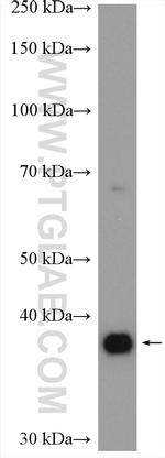 ADORA2B Antibody in Western Blot (WB)