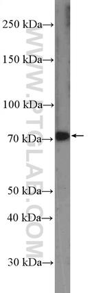 MEKK3 Antibody in Western Blot (WB)