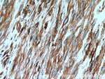 CNN2 Antibody in Immunohistochemistry (Paraffin) (IHC (P))