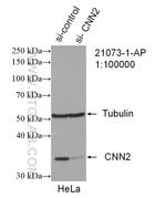 CNN2 Antibody in Western Blot (WB)