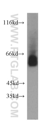ZNF703 Antibody in Western Blot (WB)