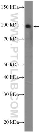 C1orf107 Antibody in Western Blot (WB)