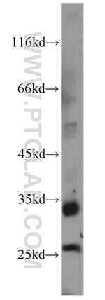 FAM119A Antibody in Western Blot (WB)