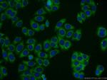 TBC1D19 Antibody in Immunocytochemistry (ICC/IF)