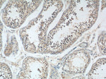 TBC1D19 Antibody in Immunohistochemistry (Paraffin) (IHC (P))