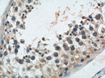 TBC1D19 Antibody in Immunohistochemistry (Paraffin) (IHC (P))