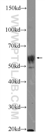 TBC1D19 Antibody in Western Blot (WB)