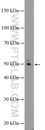 TBC1D19 Antibody in Western Blot (WB)
