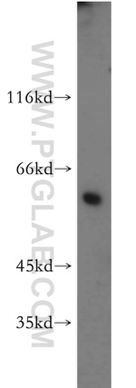 GCM2 Antibody in Western Blot (WB)