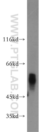 GCM2 Antibody in Western Blot (WB)