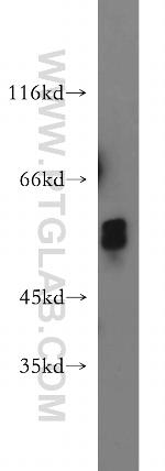 GCM2 Antibody in Western Blot (WB)