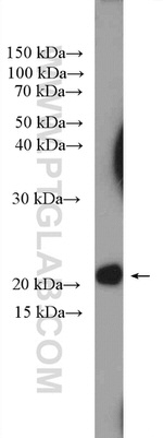 CHCHD4 Antibody in Western Blot (WB)