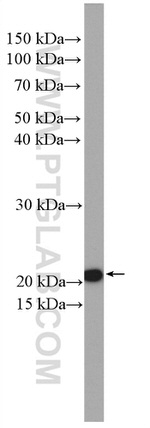 CHCHD4 Antibody in Western Blot (WB)