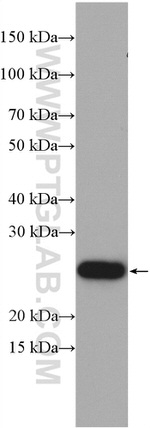 CHCHD4 Antibody in Western Blot (WB)