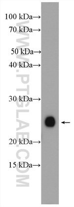 CHCHD4 Antibody in Western Blot (WB)