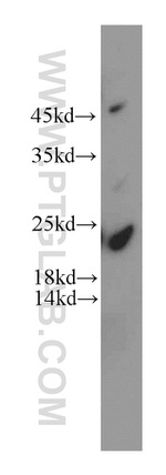 HDDC3 Antibody in Western Blot (WB)