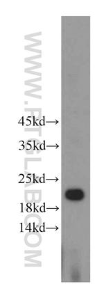 HDDC3 Antibody in Western Blot (WB)