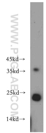 HDDC3 Antibody in Western Blot (WB)